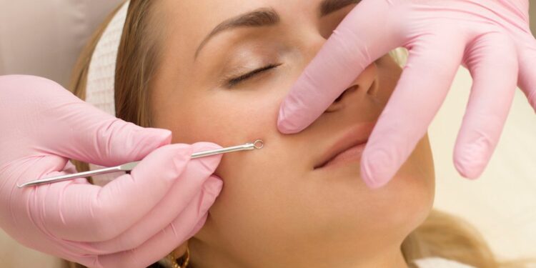 Anti-Aging-Geheimnisse: Wie man Falten natürlich reduziert